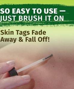 Hempvana End Tag Skin Tag Remover - As Seen On TV Accessories