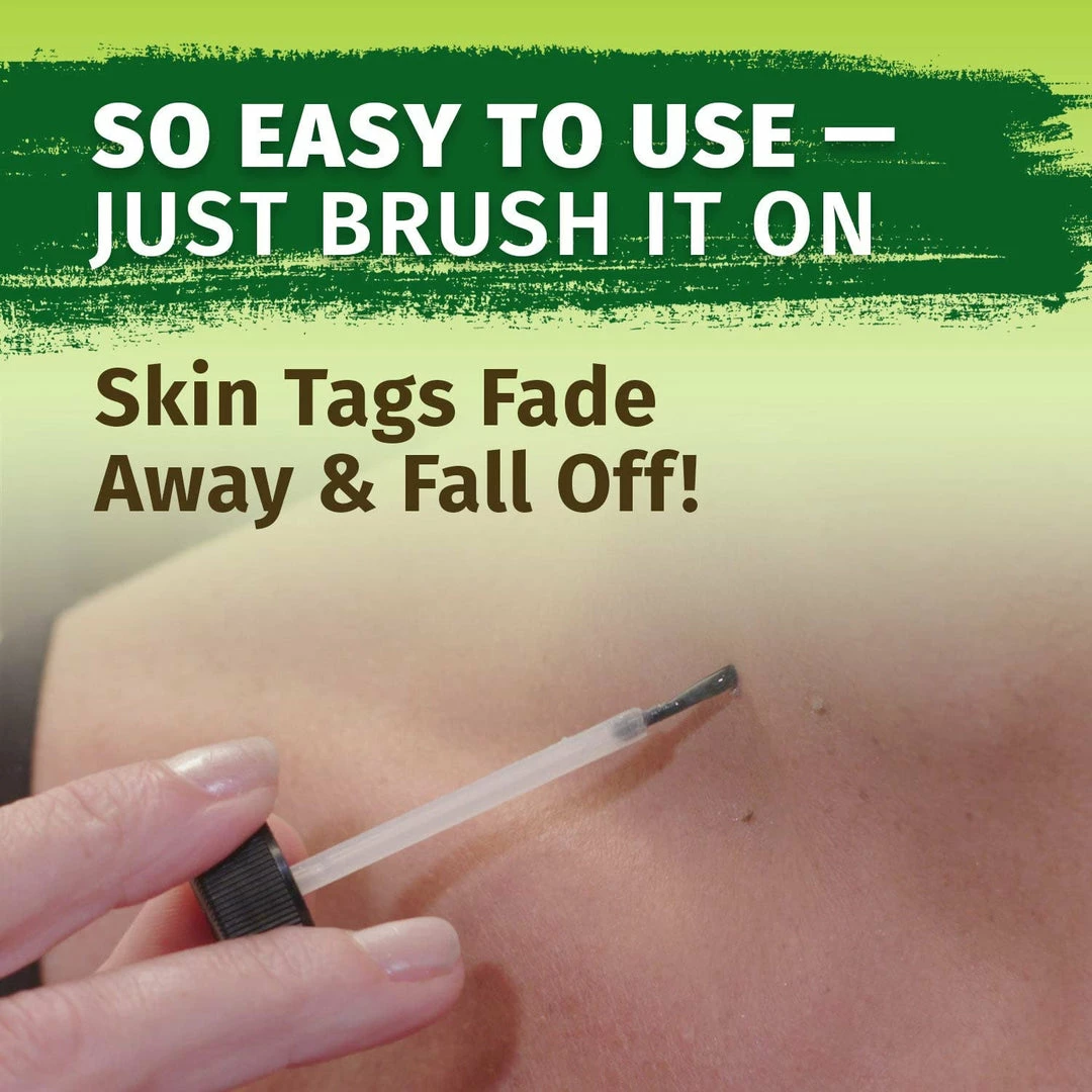 Hempvana End Tag Skin Tag Remover - As Seen On TV Accessories