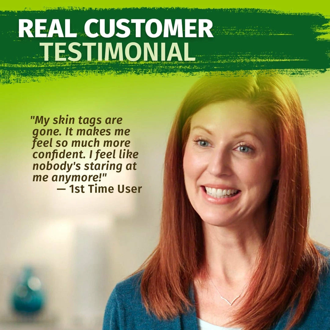 Hempvana End Tag Skin Tag Remover - As Seen On TV Accessories