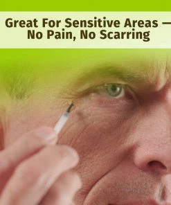 Hempvana End Tag Skin Tag Remover - As Seen On TV Accessories