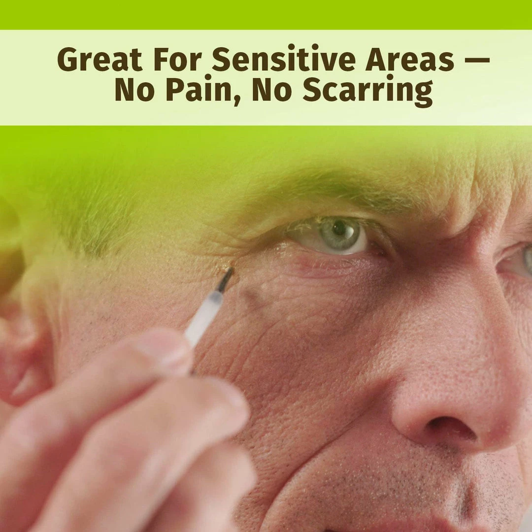 Hempvana End Tag Skin Tag Remover - As Seen On TV Accessories