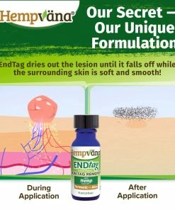 Hempvana End Tag Skin Tag Remover - As Seen On TV Accessories