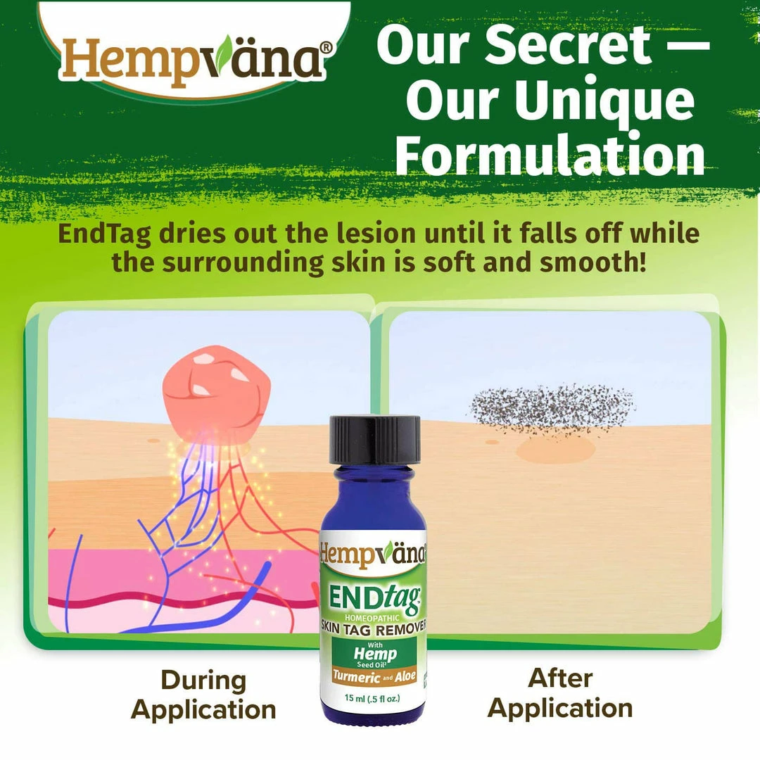 Hempvana End Tag Skin Tag Remover - As Seen On TV Accessories