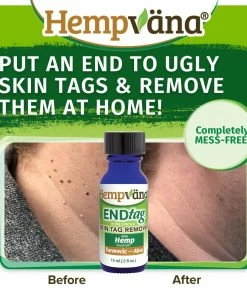 Hempvana End Tag Skin Tag Remover - As Seen On TV Accessories