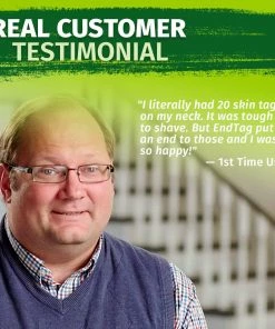 Hempvana End Tag Skin Tag Remover - As Seen On TV Accessories