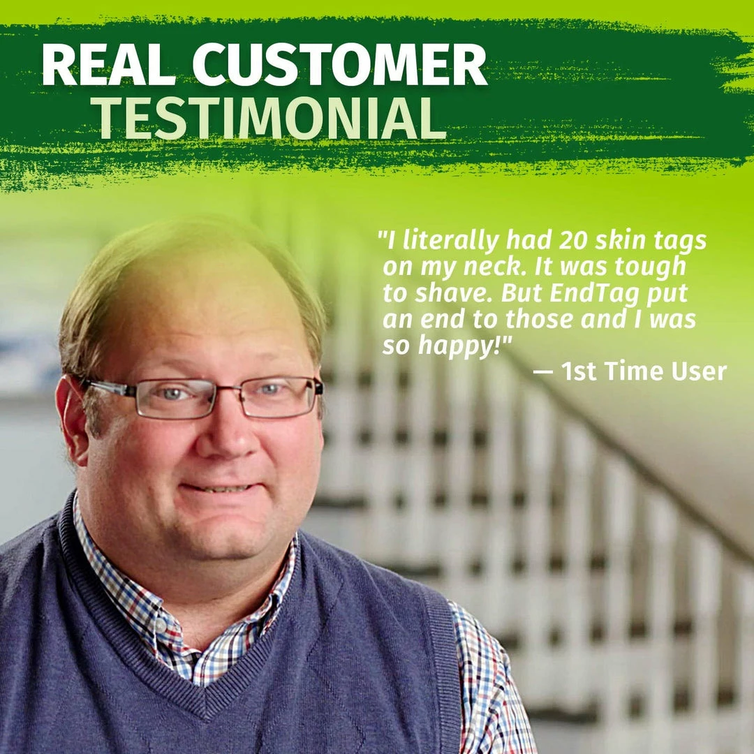 Hempvana End Tag Skin Tag Remover - As Seen On TV Accessories