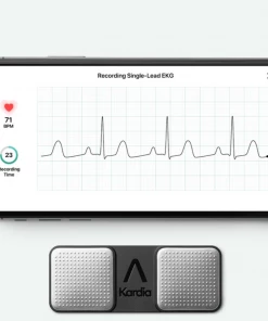 KardiaMobile Personal EKG - Heart Health At Your Fingertips