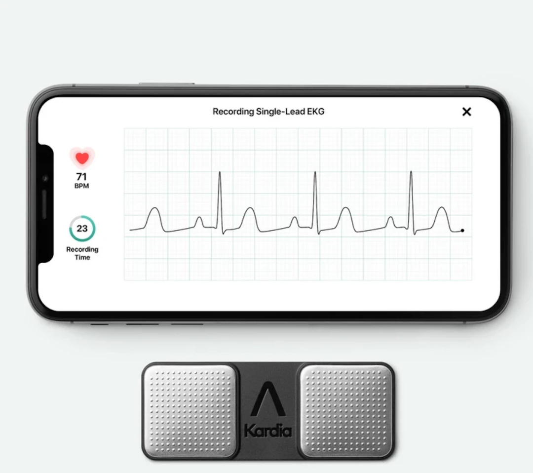 KardiaMobile Personal EKG - Heart Health At Your Fingertips